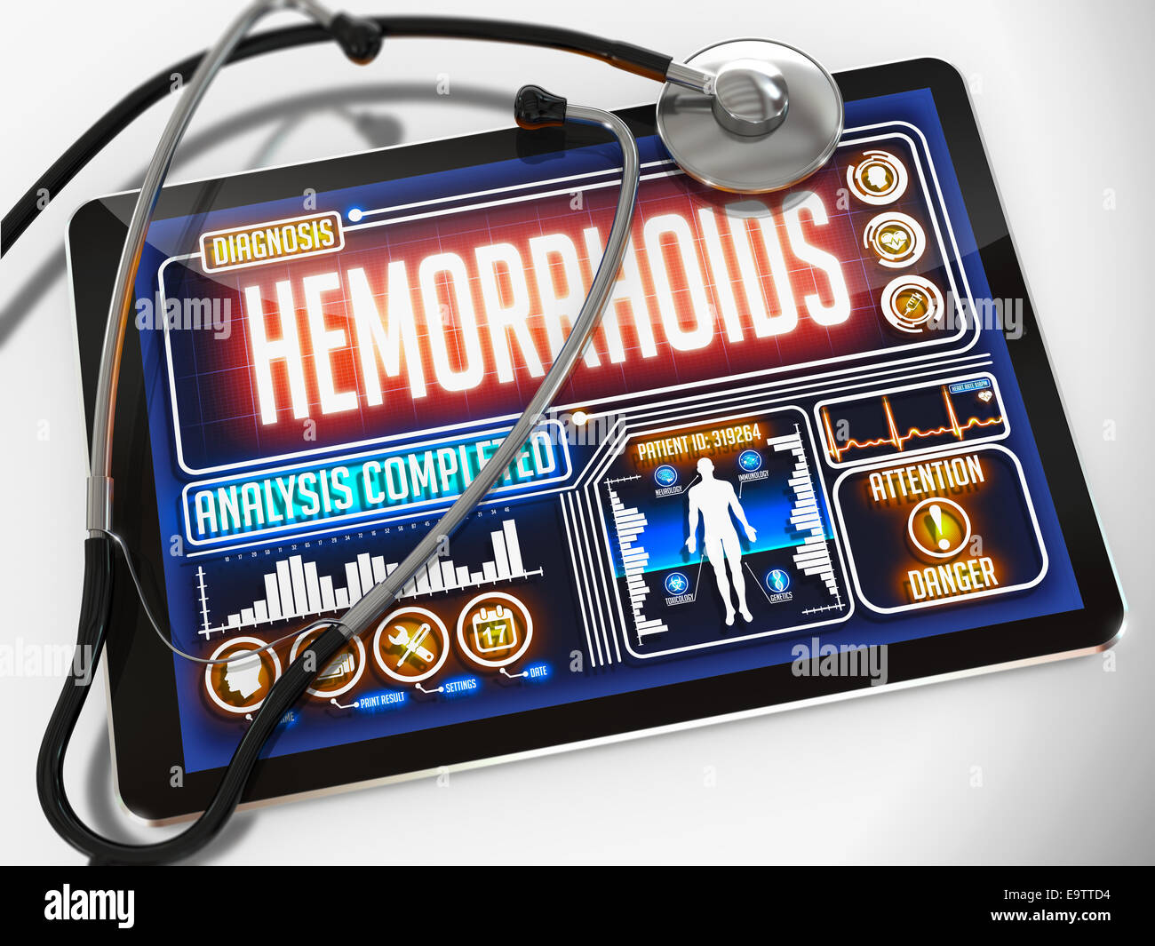 Medical Tablet with the Diagnosis of Hemorrhoids on the Display and a Black Stethoscope on White Background. Stock Photo