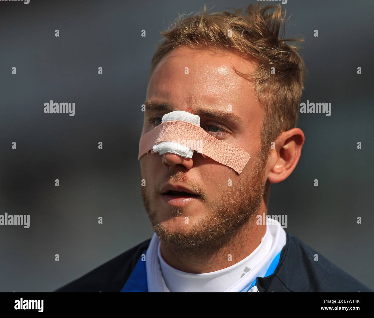 Cricket - Stuart Broad of England with bandage and plaster tape across his nose after receiving stitches to a facial injury Stock Photo