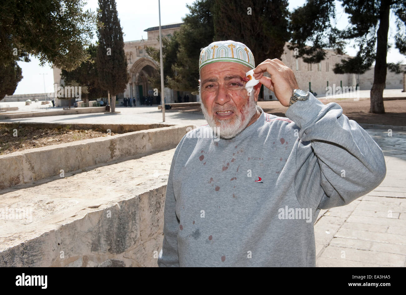 A wounded muslim is showing his wound after fighting with Israeli officers in front of the al-aqsa mosque on the temple mount Stock Photo