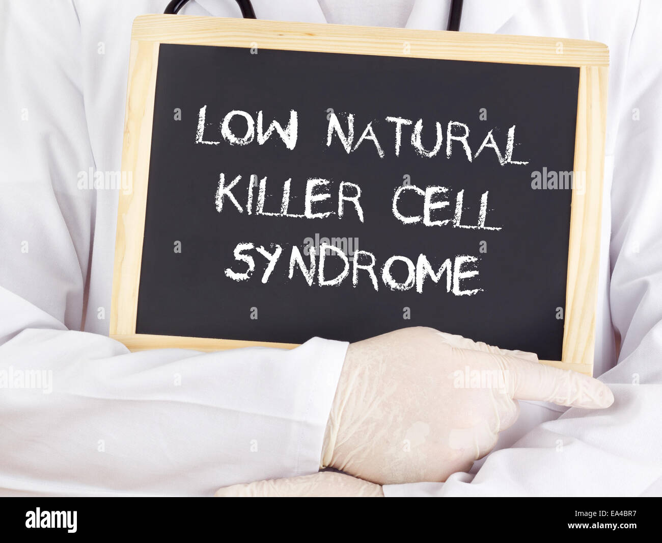 Doctor shows information low natural killer cell syndrome Stock Photo Alamy