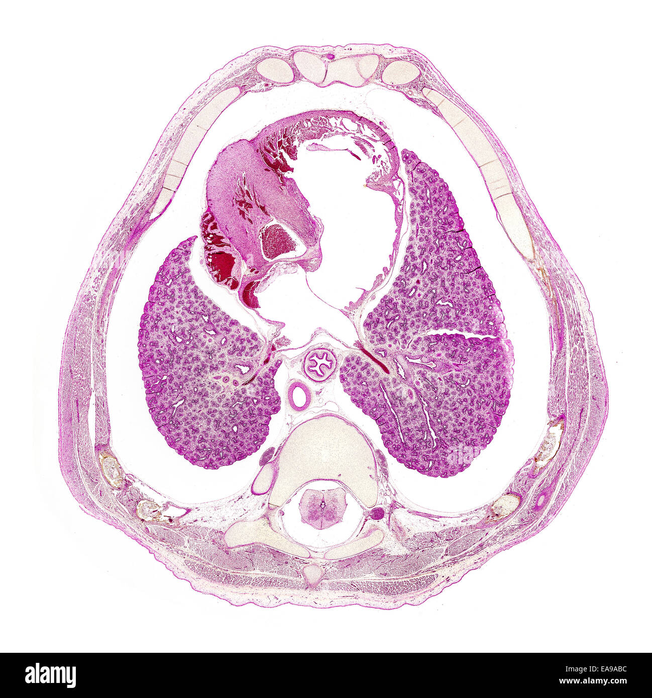 Human fetus thorax stained section showing general structures Stock Photo