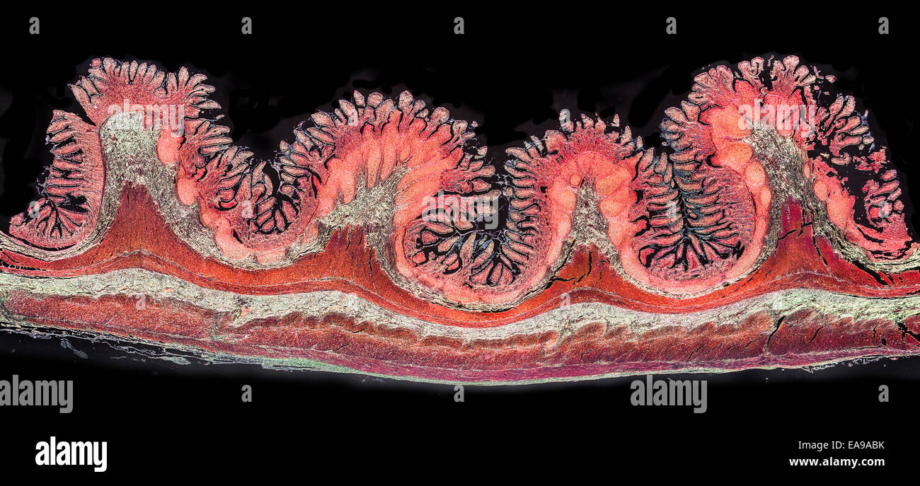 Homo sapiens small intestine villi, darkfield photomicrograph Stock Photo