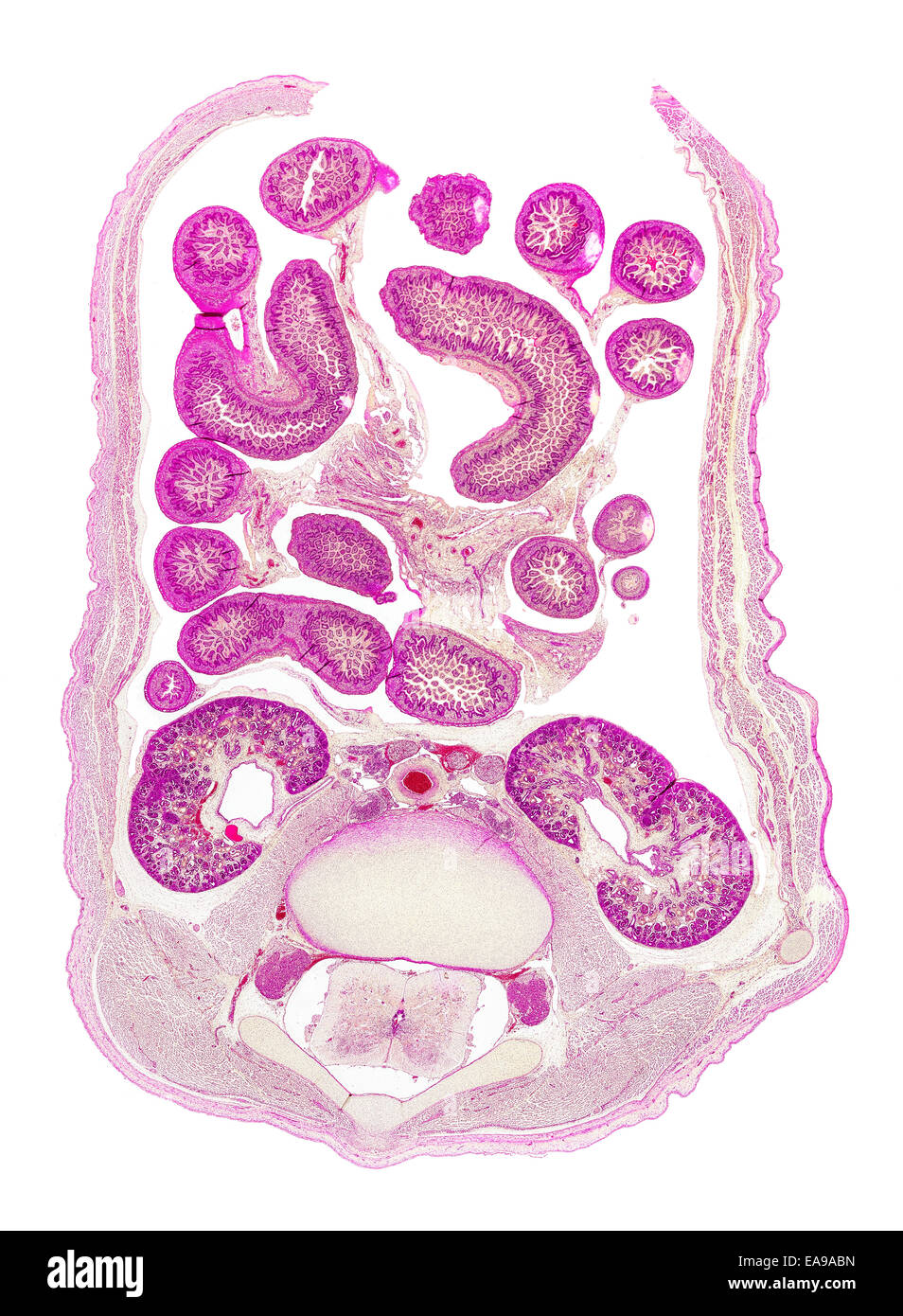 Human fetus abdomen stained section showing general structures Stock Photo