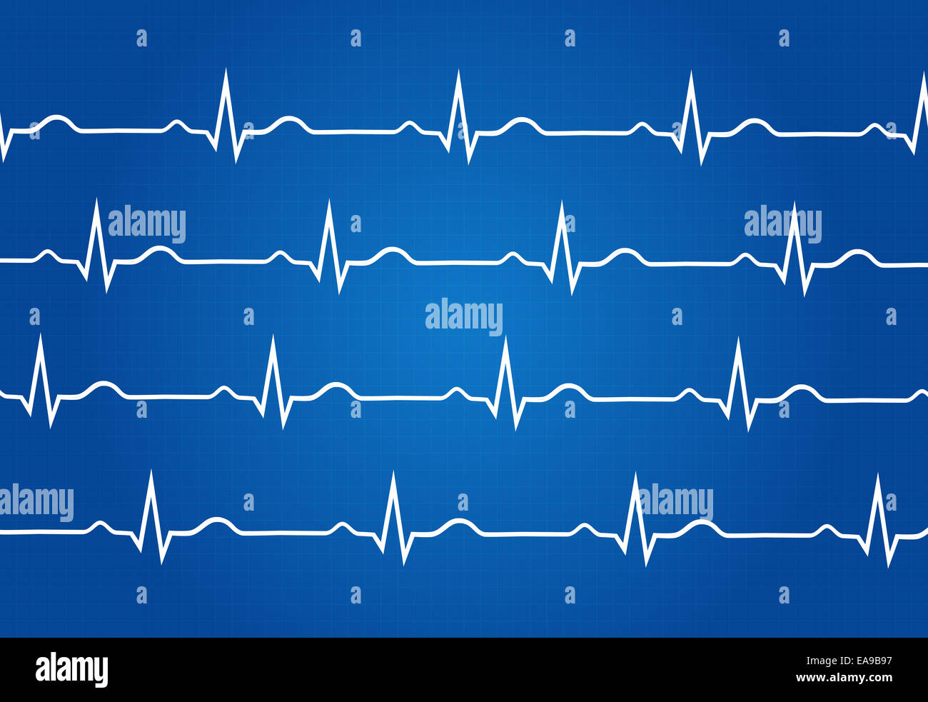 Electrocardiogram education hi-res stock photography and images - Alamy