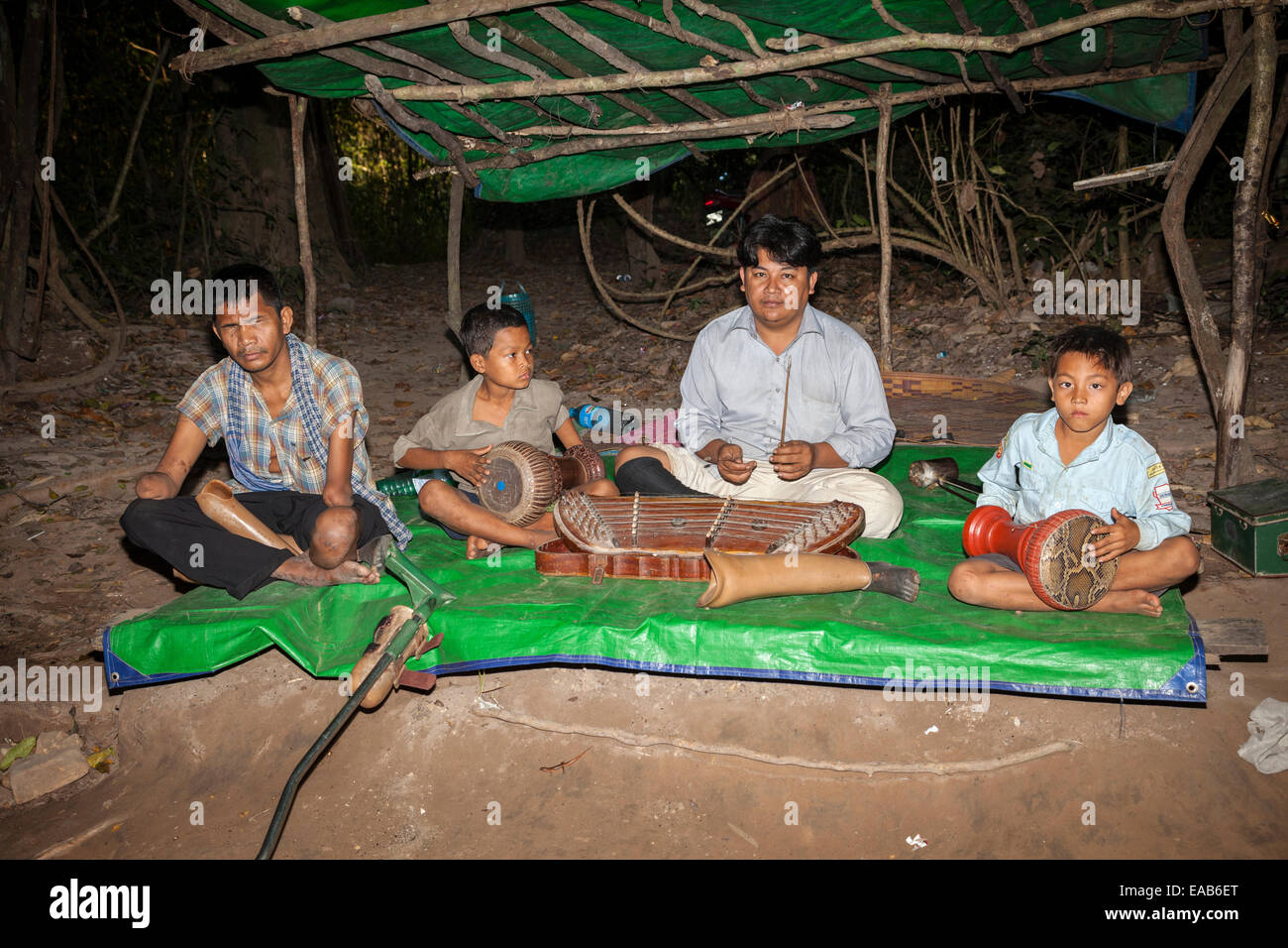 Cambodia.  Ankor Thom.  Musicians, Victims of Land Mines, Displaying their Artificial Limbs. Stock Photo