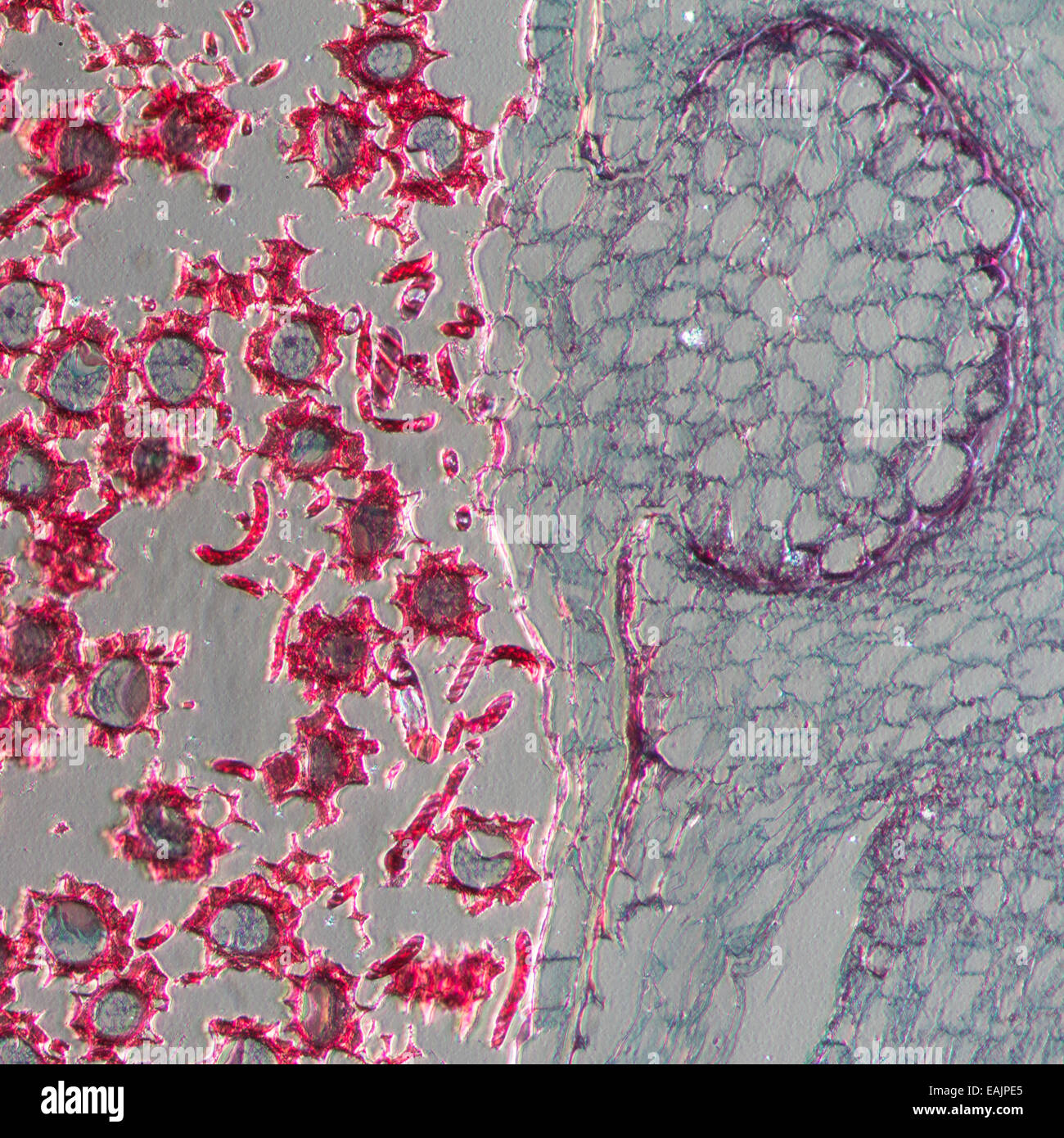 Marchrrtia liverwort mature sporophyte, L.S. Light micrography. Stock Photo