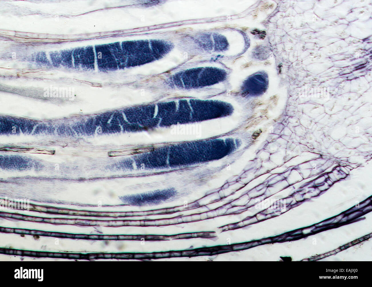 Moss antheridia, L.S. Antheridium. Light micrograph. Stock Photo