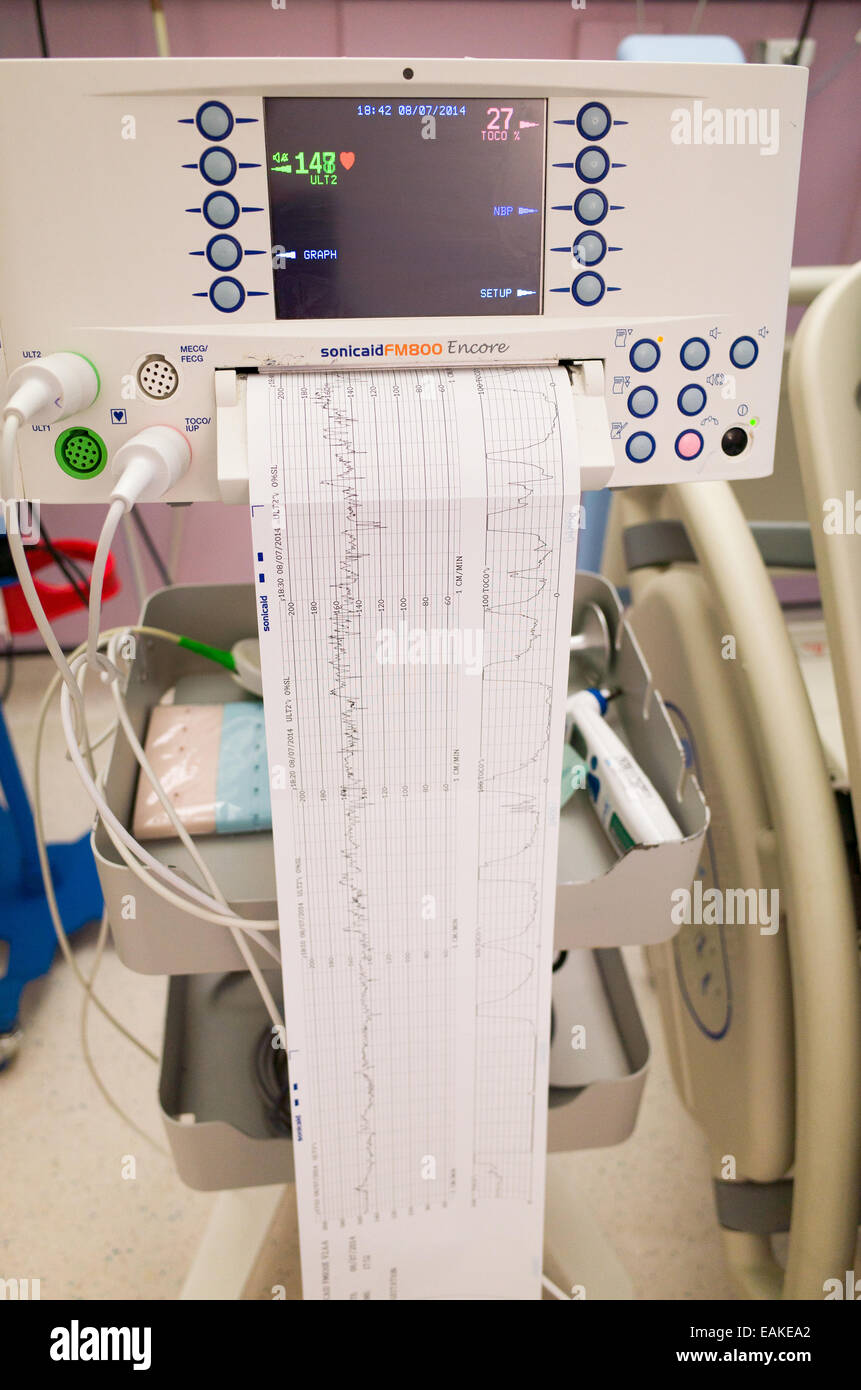 Monitor of baby's heartbeat inside womb before being born in the maternity unit, England, UK Stock Photo