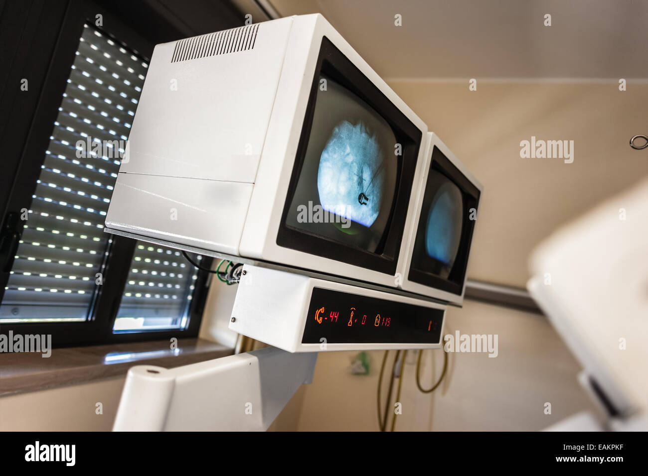 The lithotriptor attempts to break up kidney stones using an externally applied, focused, high-intensity acoustic pulse Stock Photo