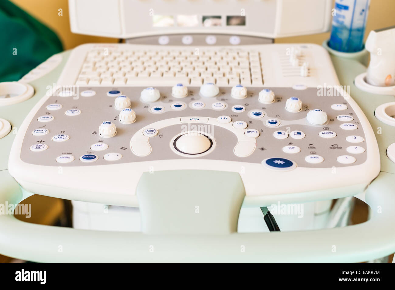 Diagnostic sonography or ultrasonography is an ultrasoundbased diagnostic imaging technique