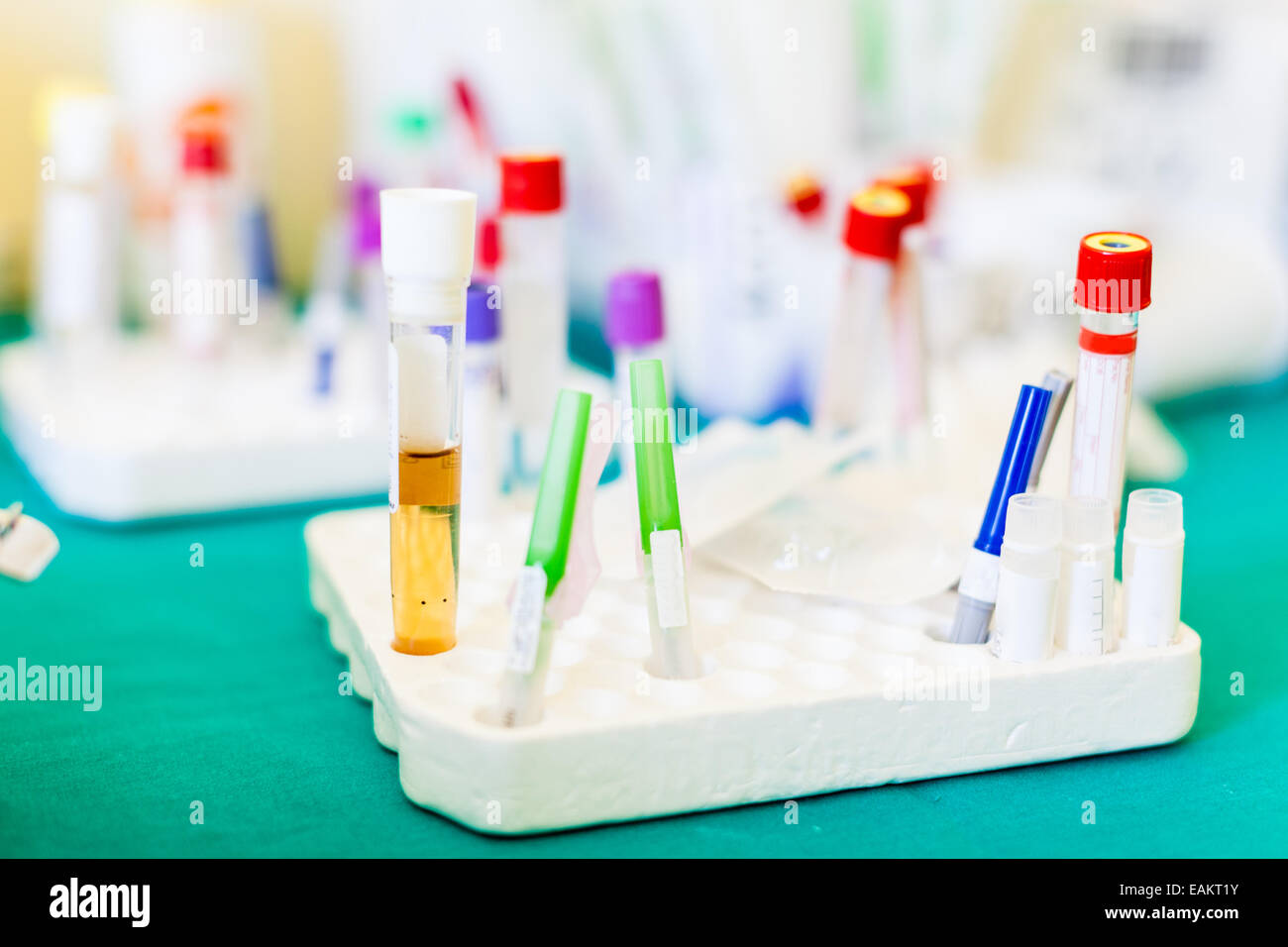 a tray with different vacuum blood vials with blood samples Stock Photo