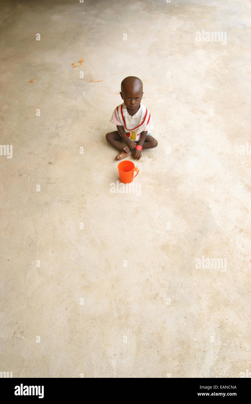 malnourished child in a clinic during the famine in 2008, nigeria Stock Photo