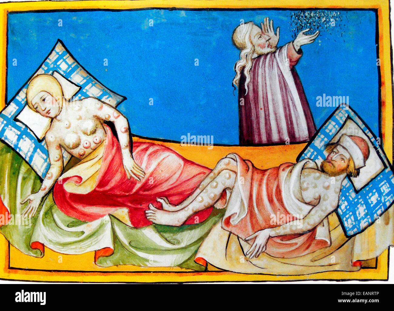 Miniature out of the Toggenburg Bible (Switzerland) of 1411. The disease is widely believed to be the plague. The location of bumps or blisters, however, ...