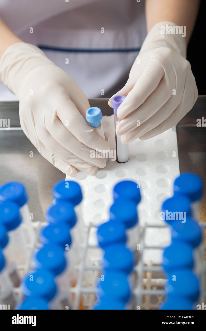 Test tube holder hires stock photography and images Alamy