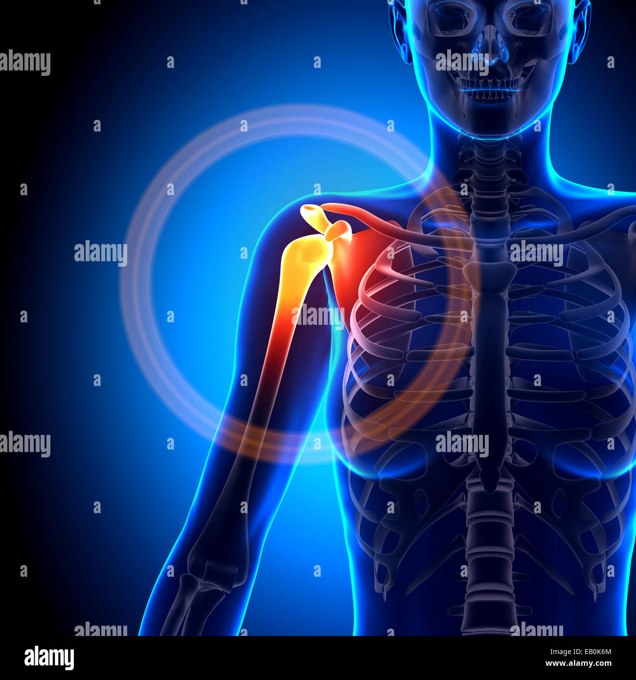 Shoulder pain xray hires stock photography and images Alamy