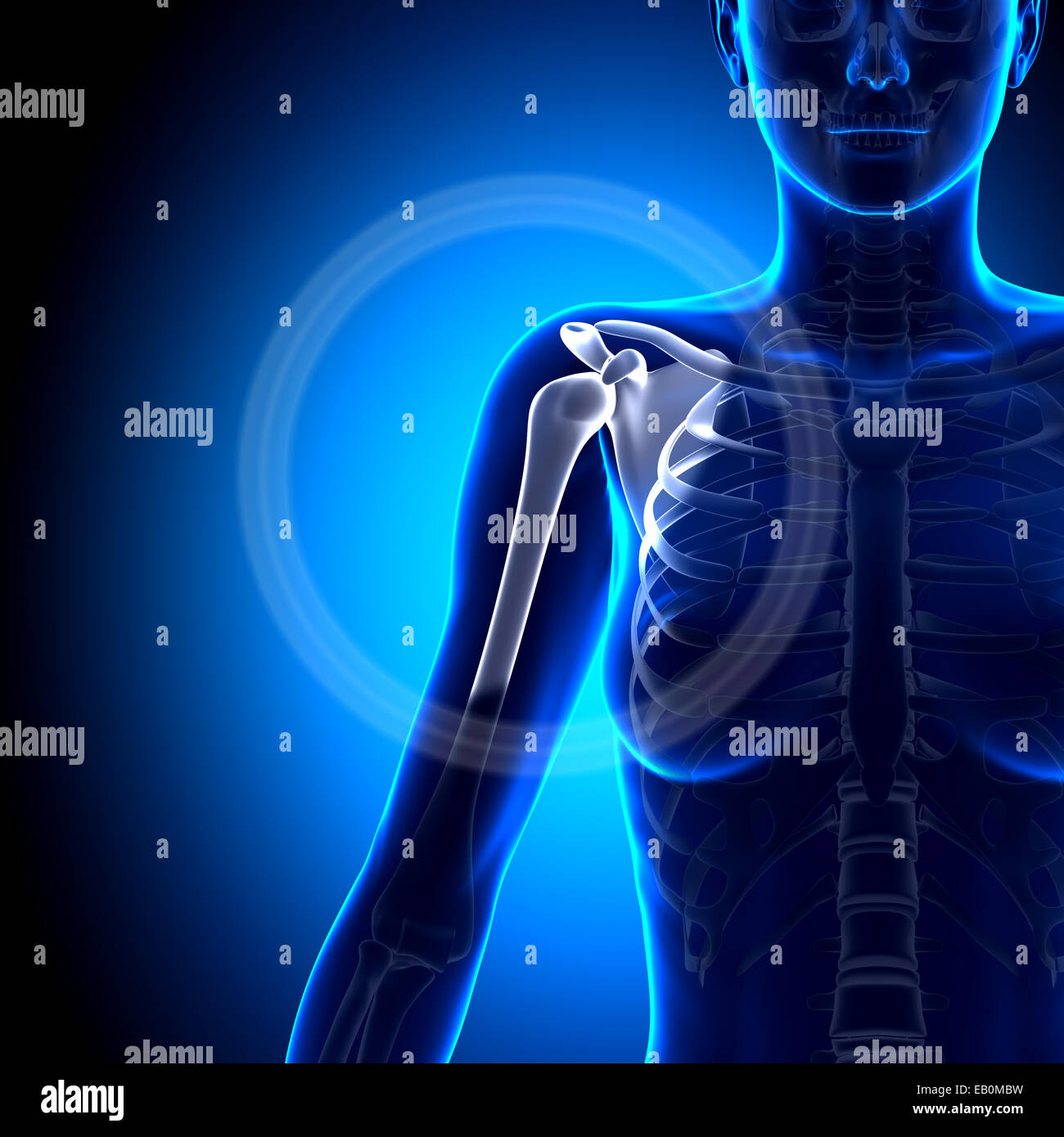 Shoulder pain xray hires stock photography and images Alamy