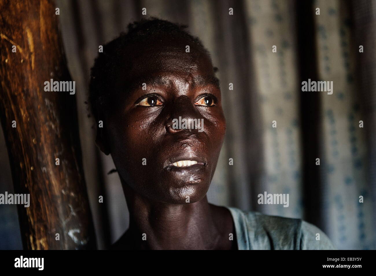 Mar 16, 2014 - Gulu, Uganda - MARGRET age 32 with 5 children. Her husband died in 2011. She gets treatment through an NGO. In 2005, 8 month pregnant Margret, co-wife and their neighbors while digging were abducted by LRA rebels and taken into the bush, killing one by by one. She survived because of the premonition fears of the rebels about what will befall their pregnant wives if they kill her. From 1987-2006 thousands were brutally killed, family members were lost and misplaced. Dignity and hope in Northern Uganda was erased due the endless war between the LRA aka the Lord's Resistance Army o Stock Photo