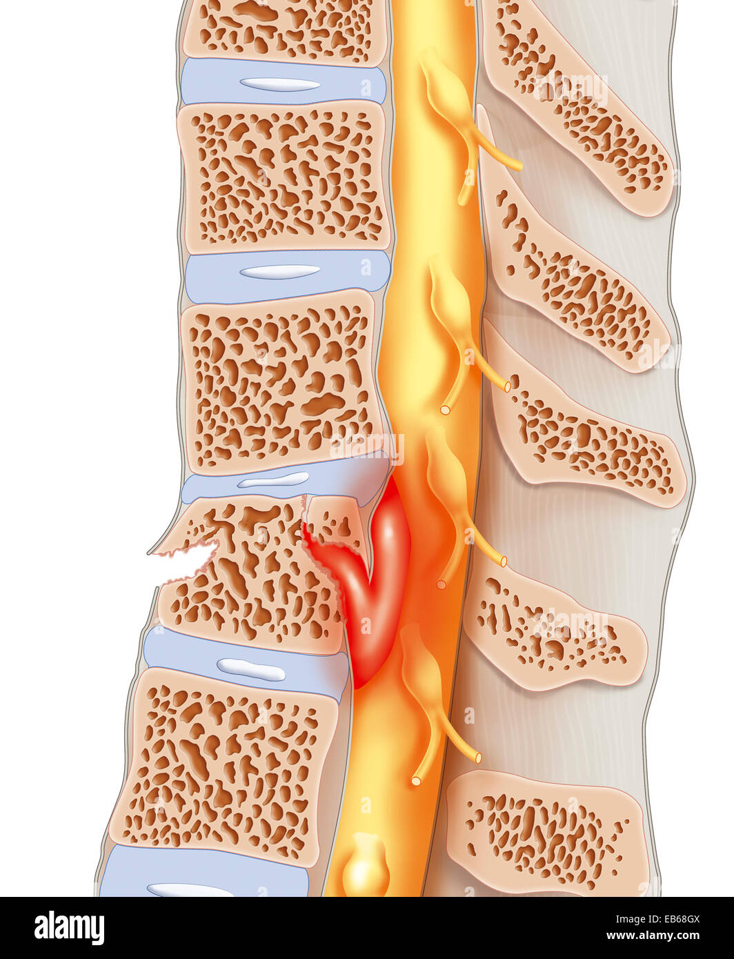 Cord compression hires stock photography and images Alamy