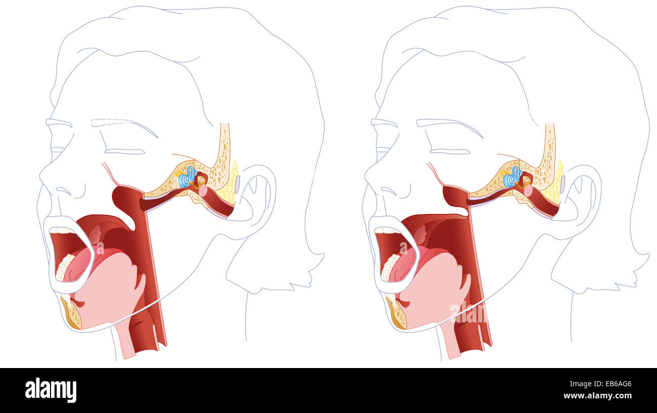 ENT, ILLUSTRATION Stock Photo