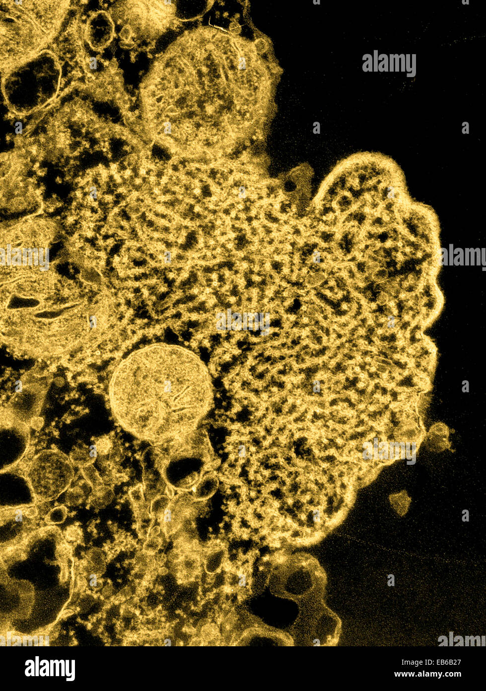 NIPAH VIRUS INFECTION Stock Photo Alamy