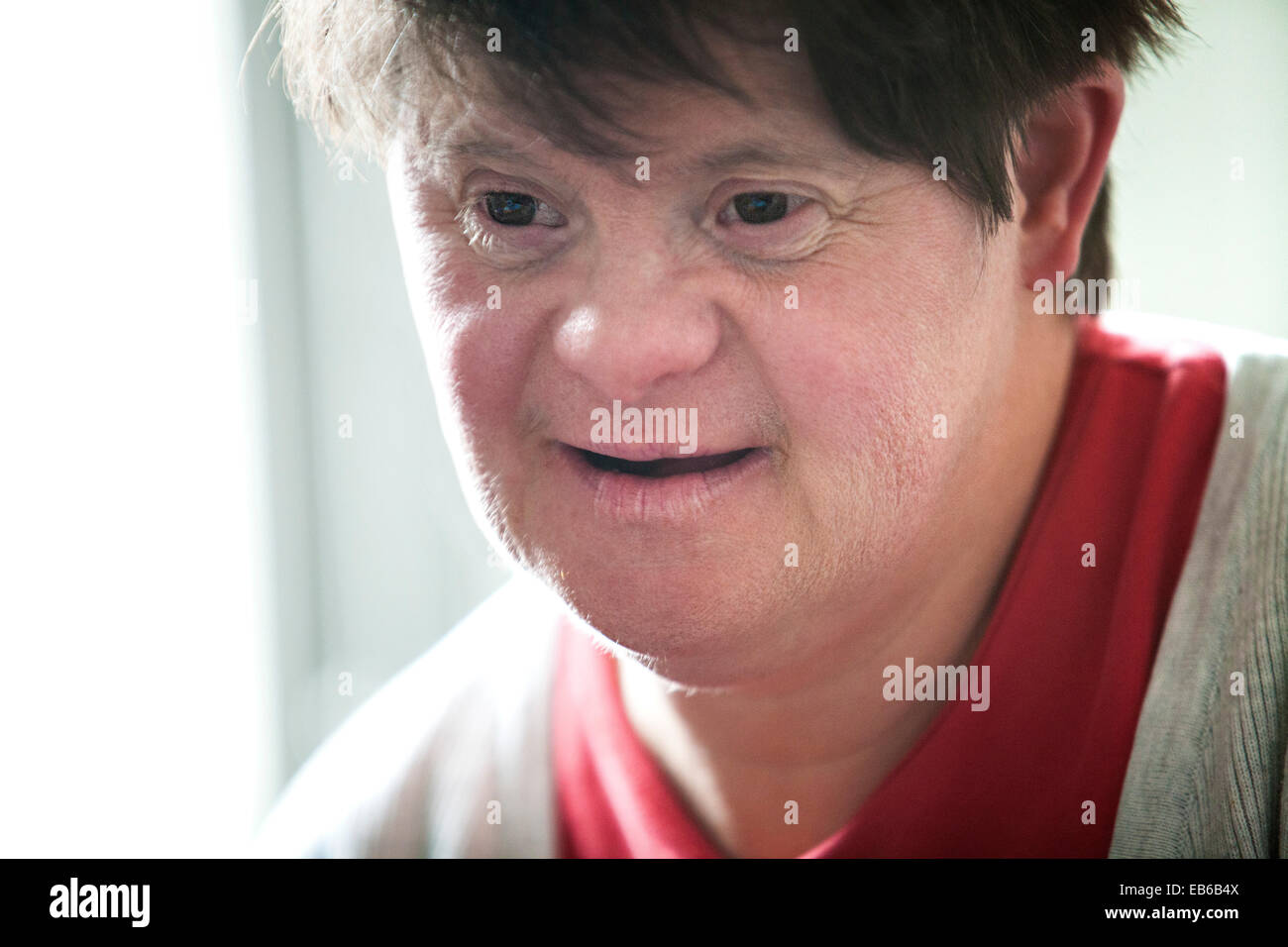 ADULT, DOWN'S SYNDROME Stock Photo