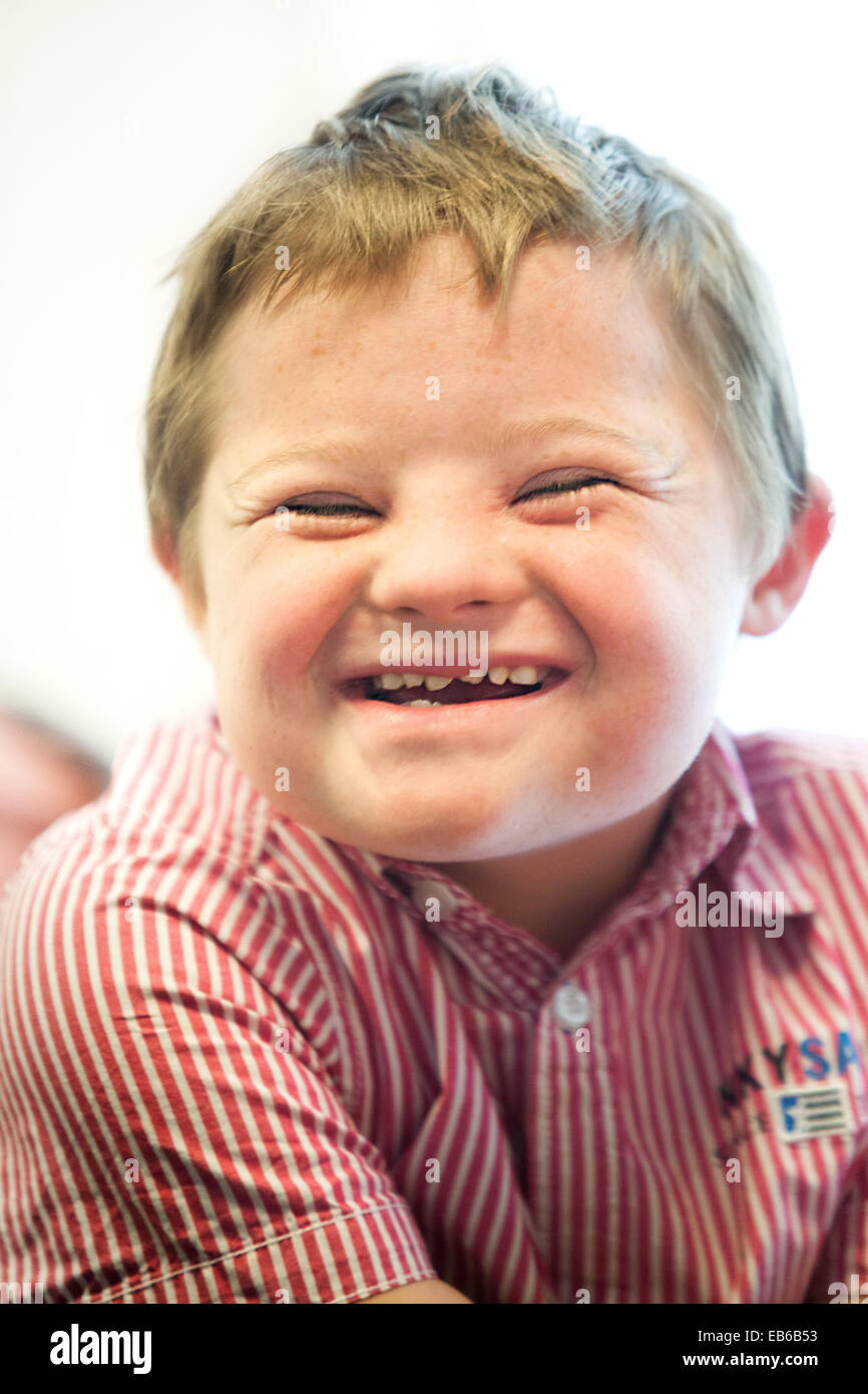 CHILD, DOWN'S SYNDROME Stock Photo Alamy