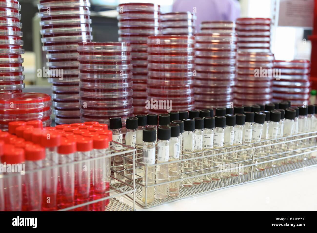 Coproculture specimens, Sample preparation, Microbiology Department