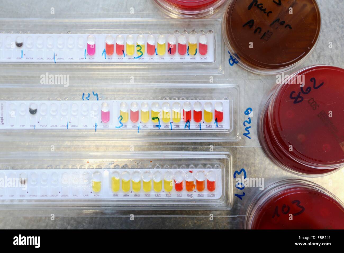 analysis analytic api bacteria based Basque Country between biochemical