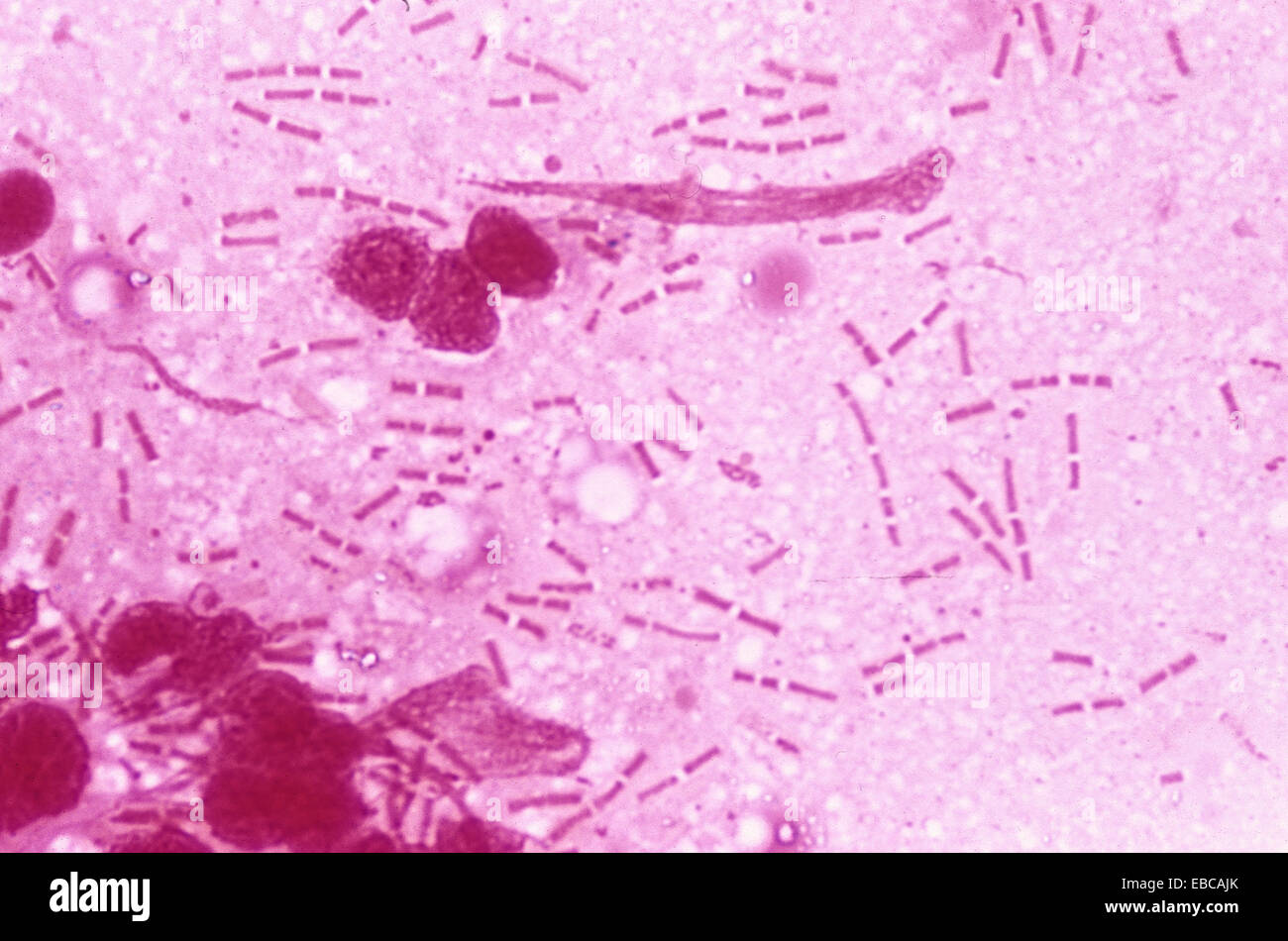 Bacillus anthracis. Grampositive patogenic bacteria, agent of Stock