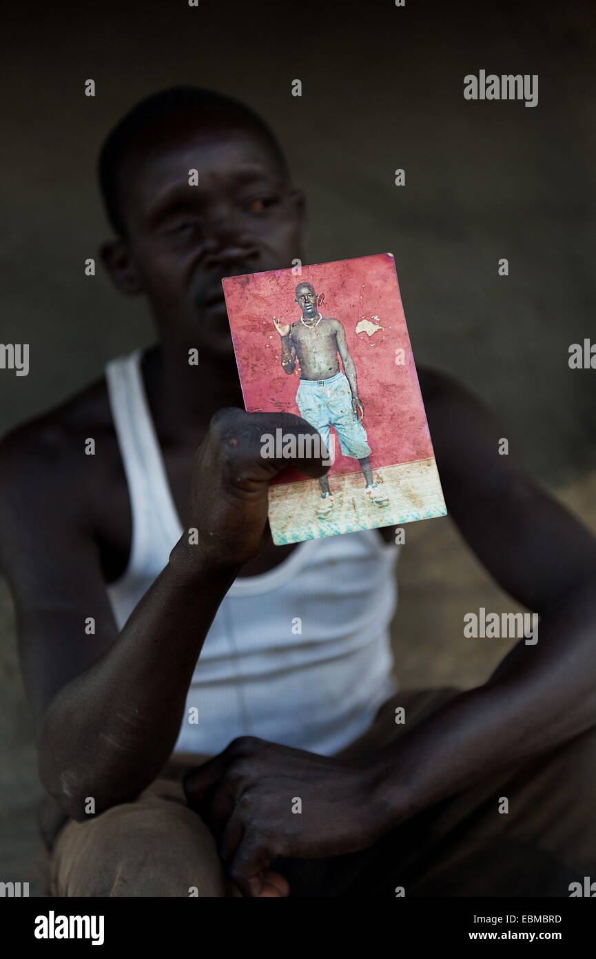Gulu, Uganda. 14th Mar, 2014. ALENSIO, 38, is staying with his two kids. While digging in his compound next to his hut, a grenade blasted his hand, face and abdomen. As most victims, he filled out the 2010 government form, with a photo showing his injuries. However, he has had no reply or assistance. © Peter Bauza/ZUMA Wire/ZUMAPRESS.com/Alamy Live News Stock Photo