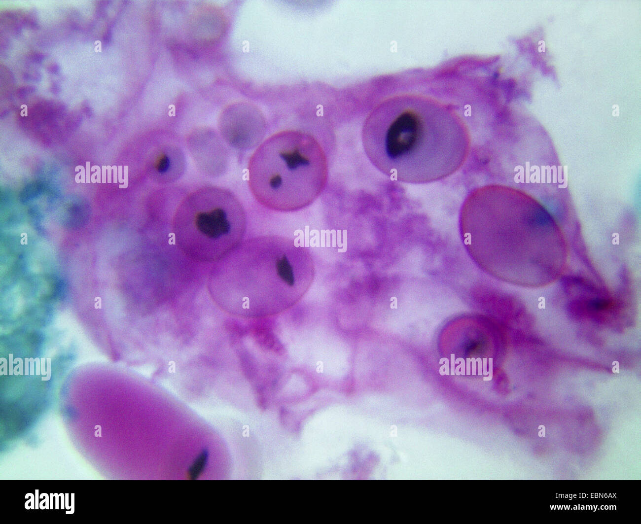 potato (Solanum tuberosum), microscopic picture of potato starch grains, 1000 x Stock Photo