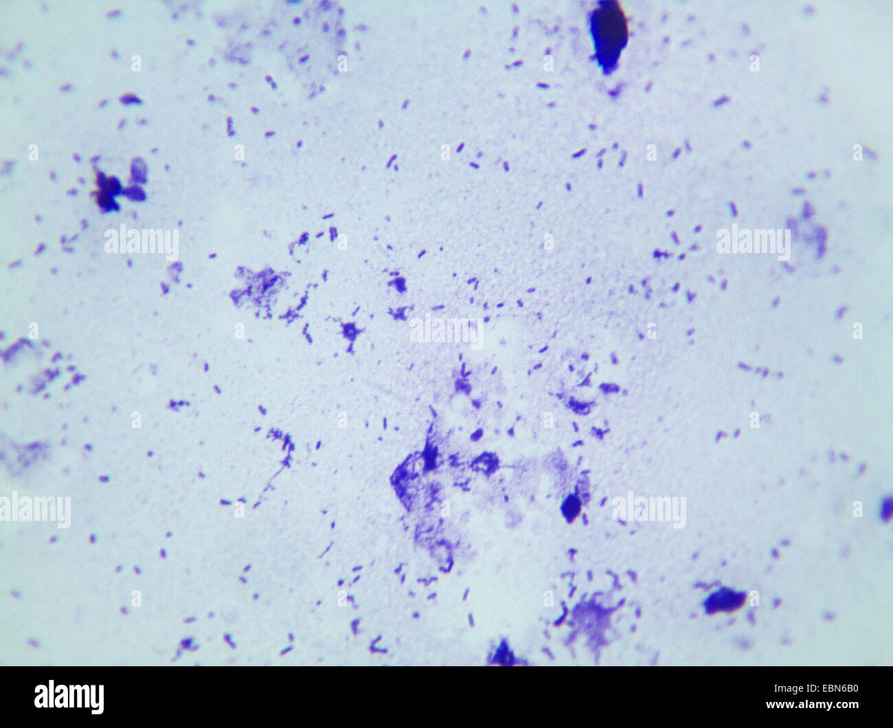 cheese bacteria, 1000 x Stock Photo Alamy