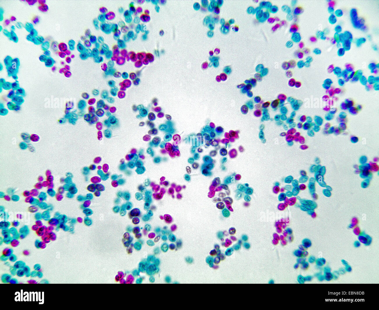 yeast cells, 1000 x Stock Photo