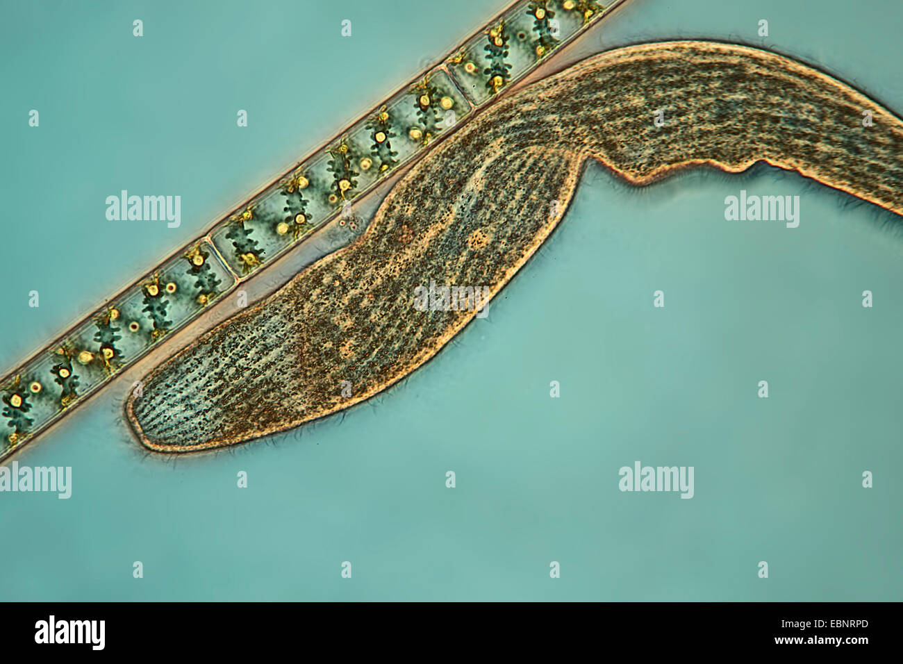 Spirostomum with green alga im phase-contrast and interference contrast Stock Photo