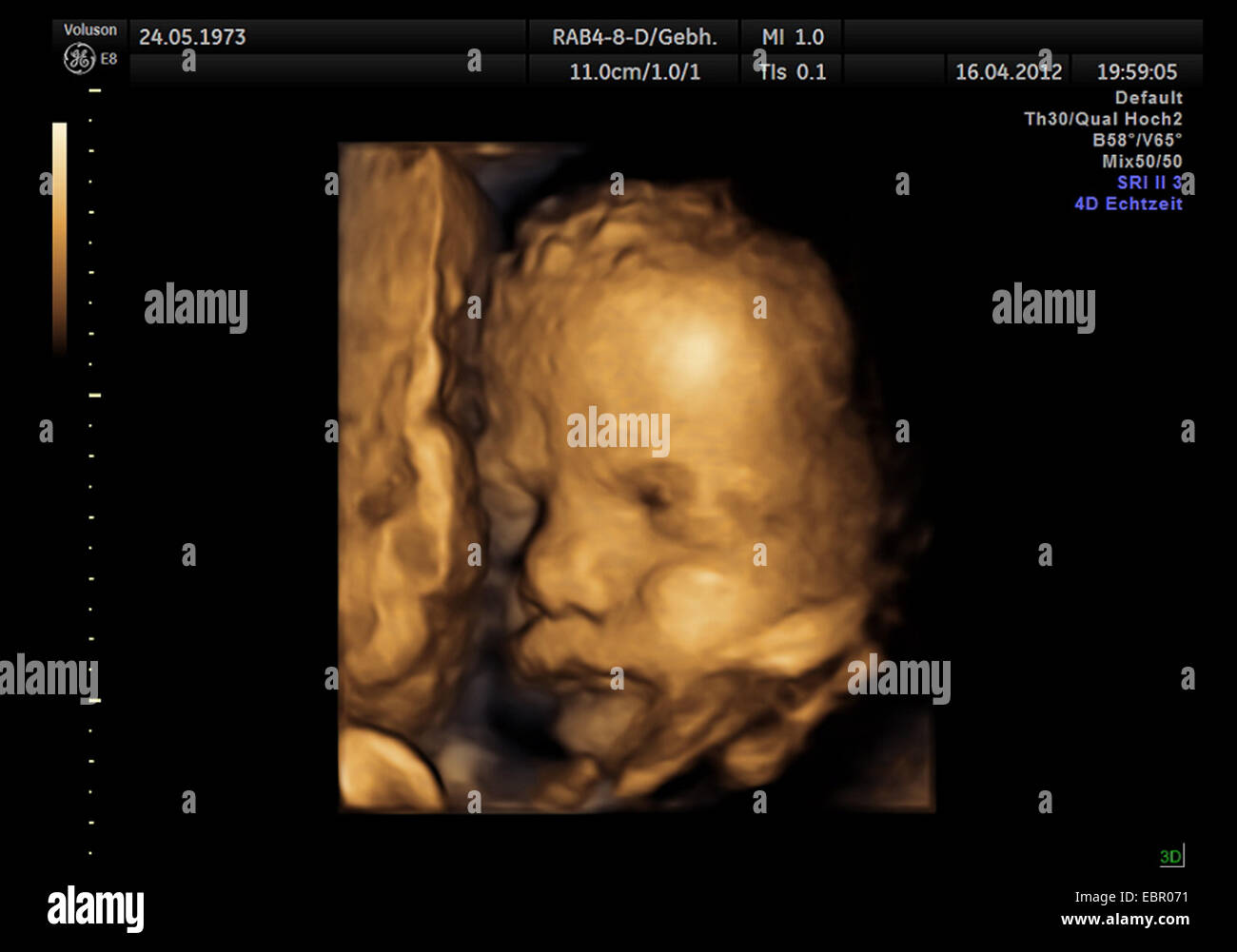 4D portrait of an embryo in the womb Stock Photo