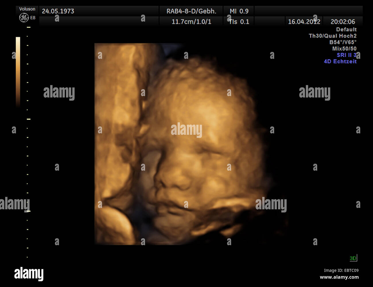 4D portrait of an embryo in the womb Stock Photo