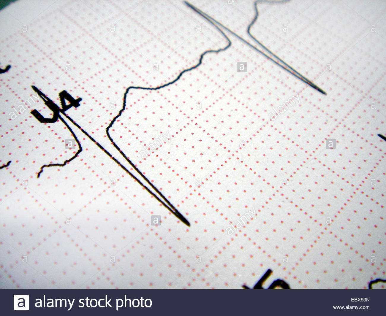 Ecg Graph Stock Photos & Ecg Graph Stock Images - Alamy