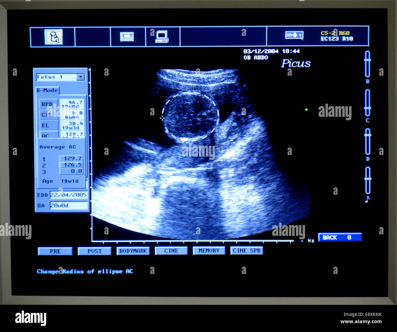 Ultrasonic testing, ultrasonic scan Stock Photo Alamy