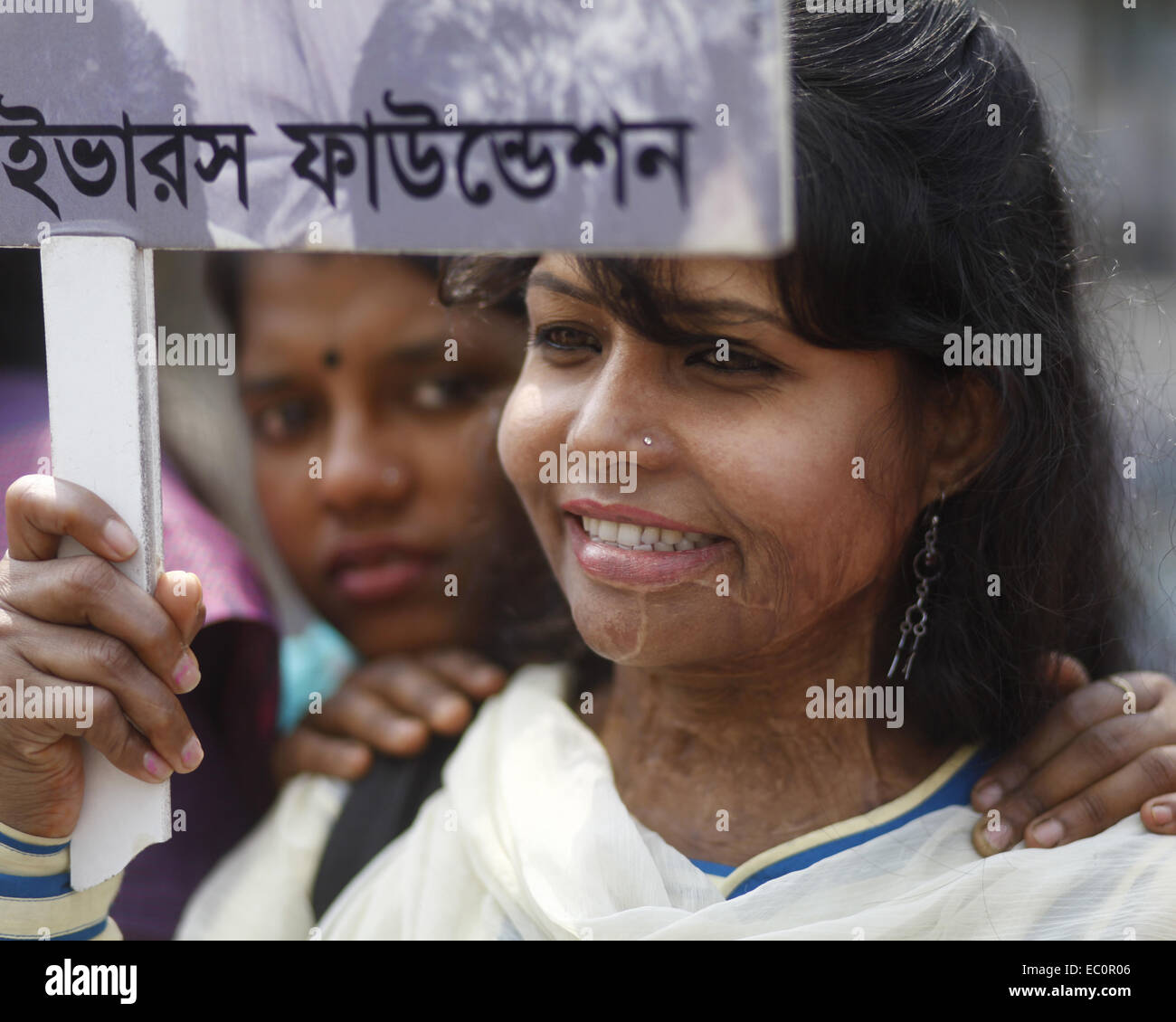 Dhaka, Bangladesh. 7th Mar, 2014. Dhaka, Bangladesh, 07th March 2014:.Survivors of acid attacks, attend a human chain to protest against acid violence on the eve of the International Women's Day celebration in Dhaka, Bangladesh. According to Acid Survivors Foundation (ASF), there had been 3,184 acid attacks since February 1999 to February 2014 in Bangladesh, where 1,792 women were victims among a total of 3,512. Acid attacks are mostly common in Cambodia, Pakistan, Afganistan, India, Bangladesh and nearby other countries. It is estimated that some 80 percent of the victims of acid attacks ar Stock Photo