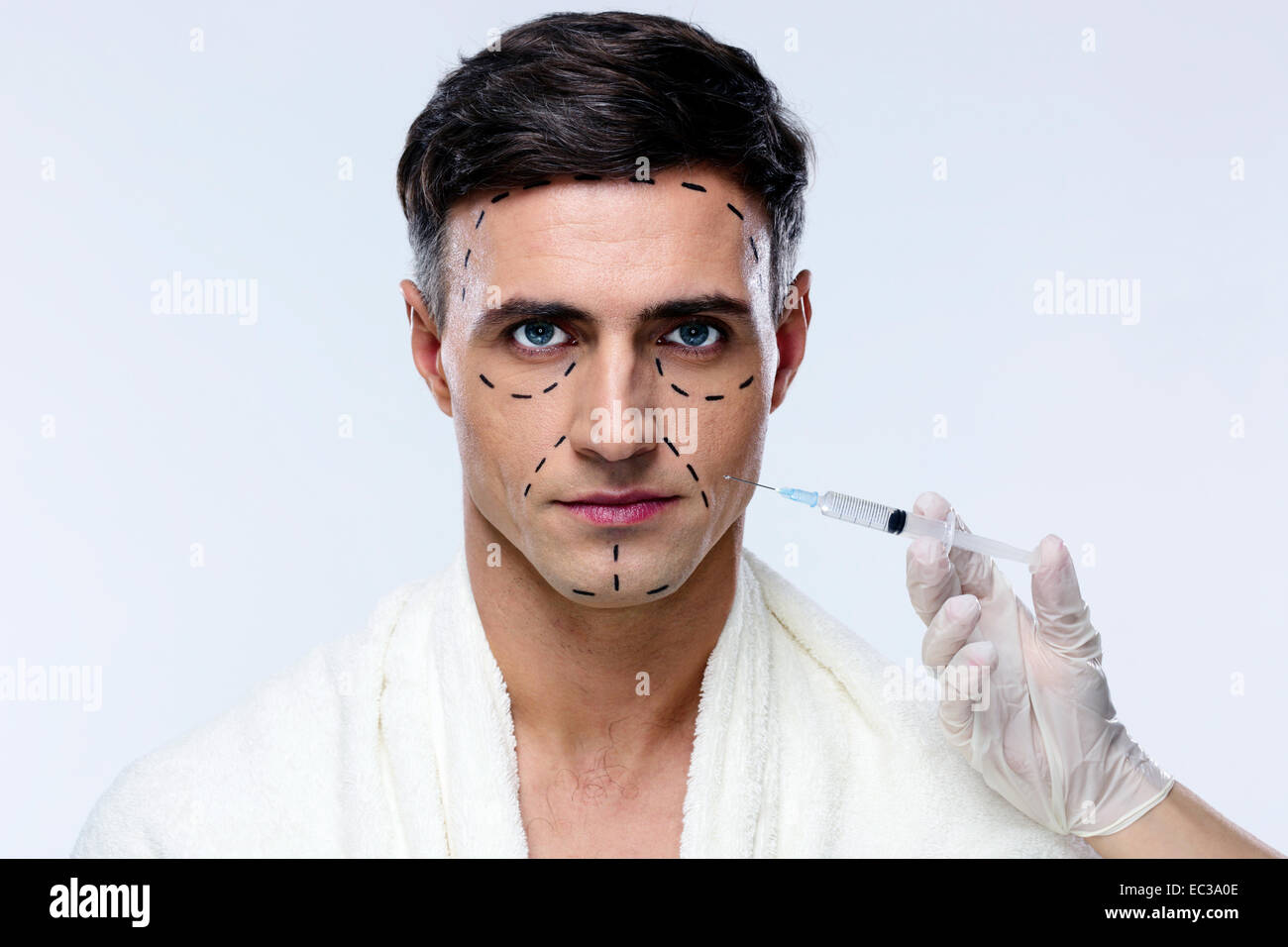 джастин джедлик джастин до операций. мужская пластическая операция. пластическая хирургия. мужчина с пластическими операциями. мужская косметология лица.