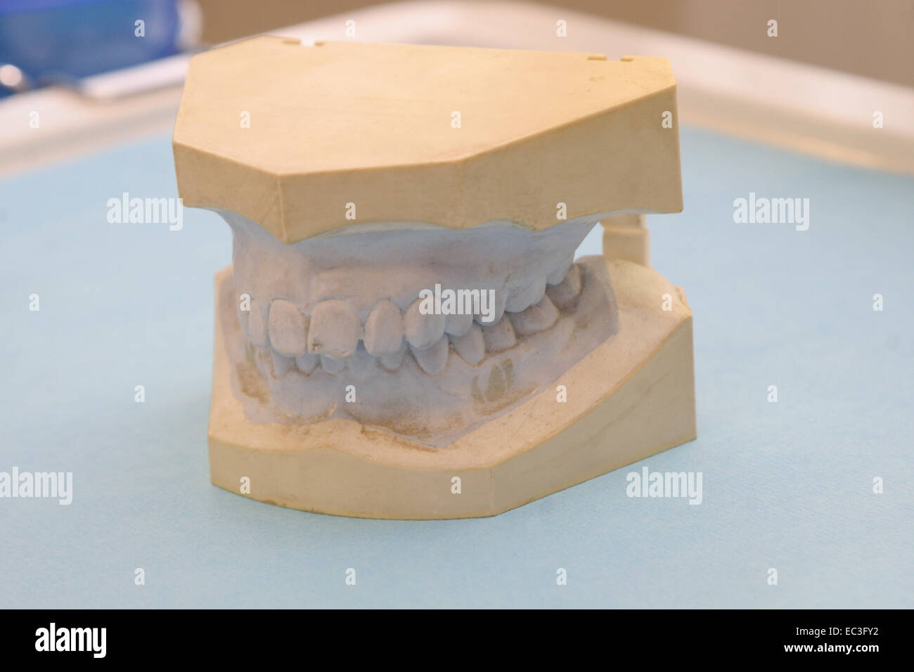 Impression, Upper Lower Jaw Stock Photo Alamy