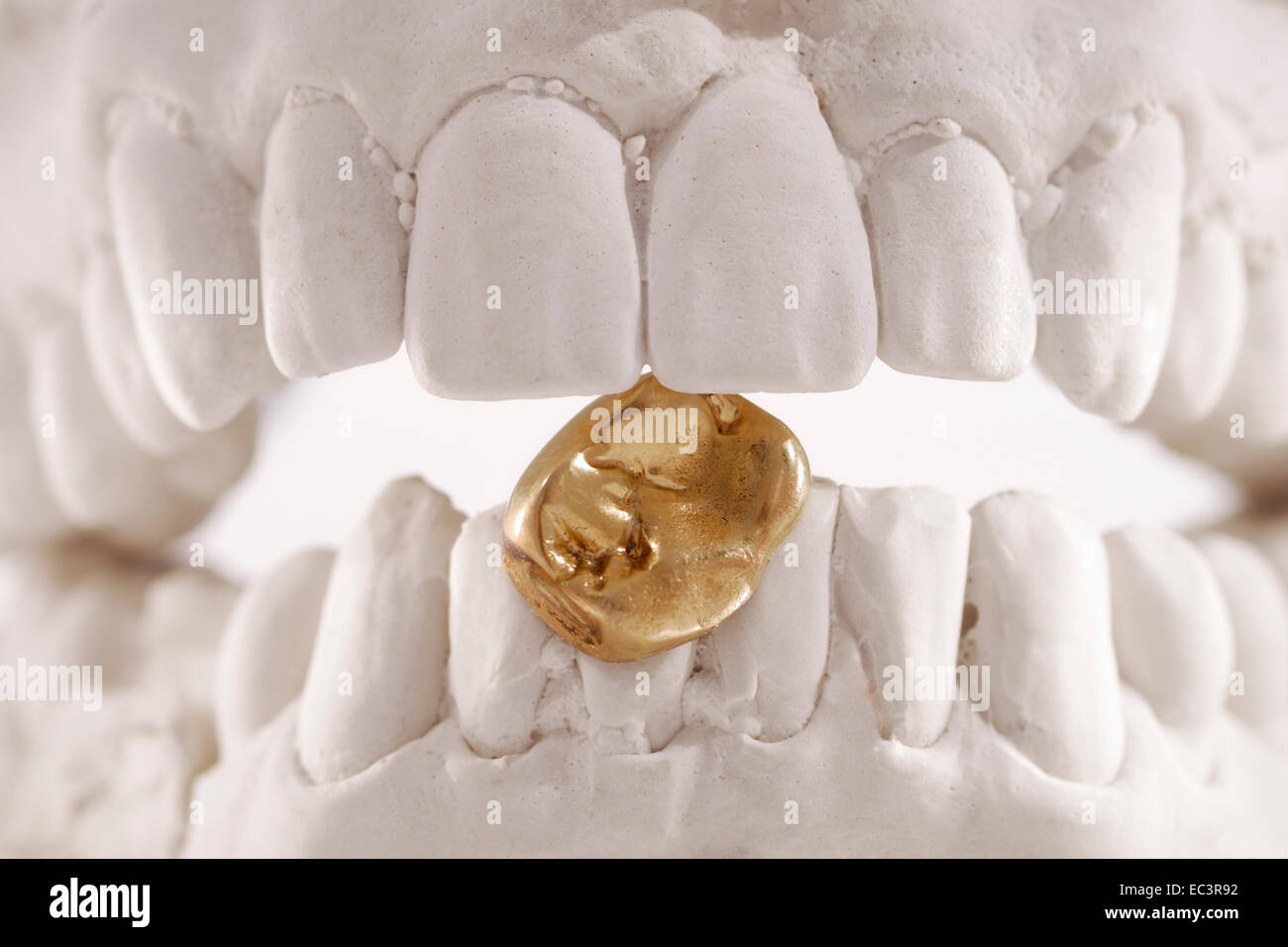 Dental Plaster Cast with Gold Tooth Stock Photo Alamy