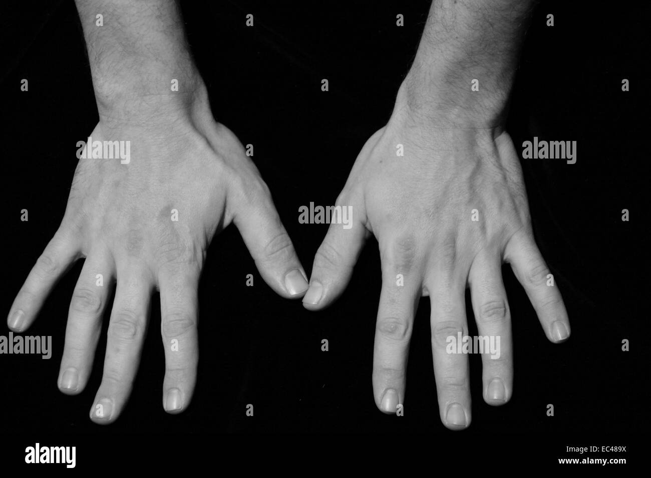 Hands anatomy Black and White Stock Photos & Images - Alamy