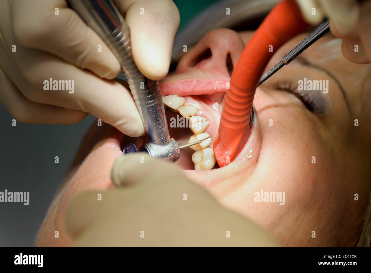 Dentist separated on dental crowns Stock Photo