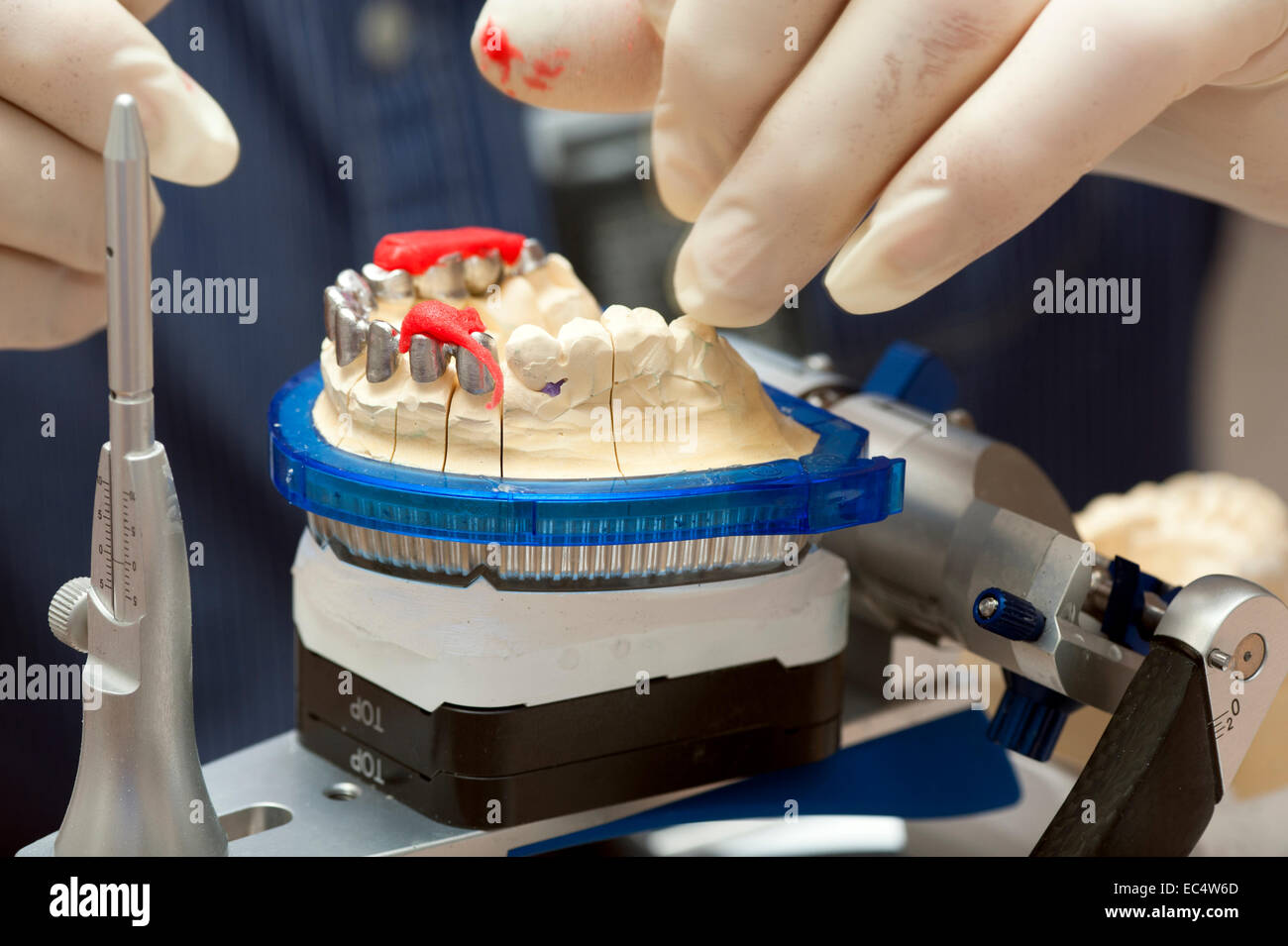 Upper jaw model with mass for the bite level Stock Photo - Alamy