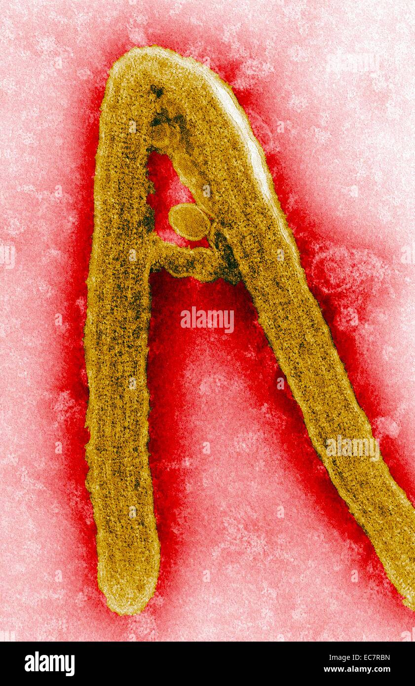 transmission electron microscope image Marburg virus virion grown of tissue culture cells Stock Photo