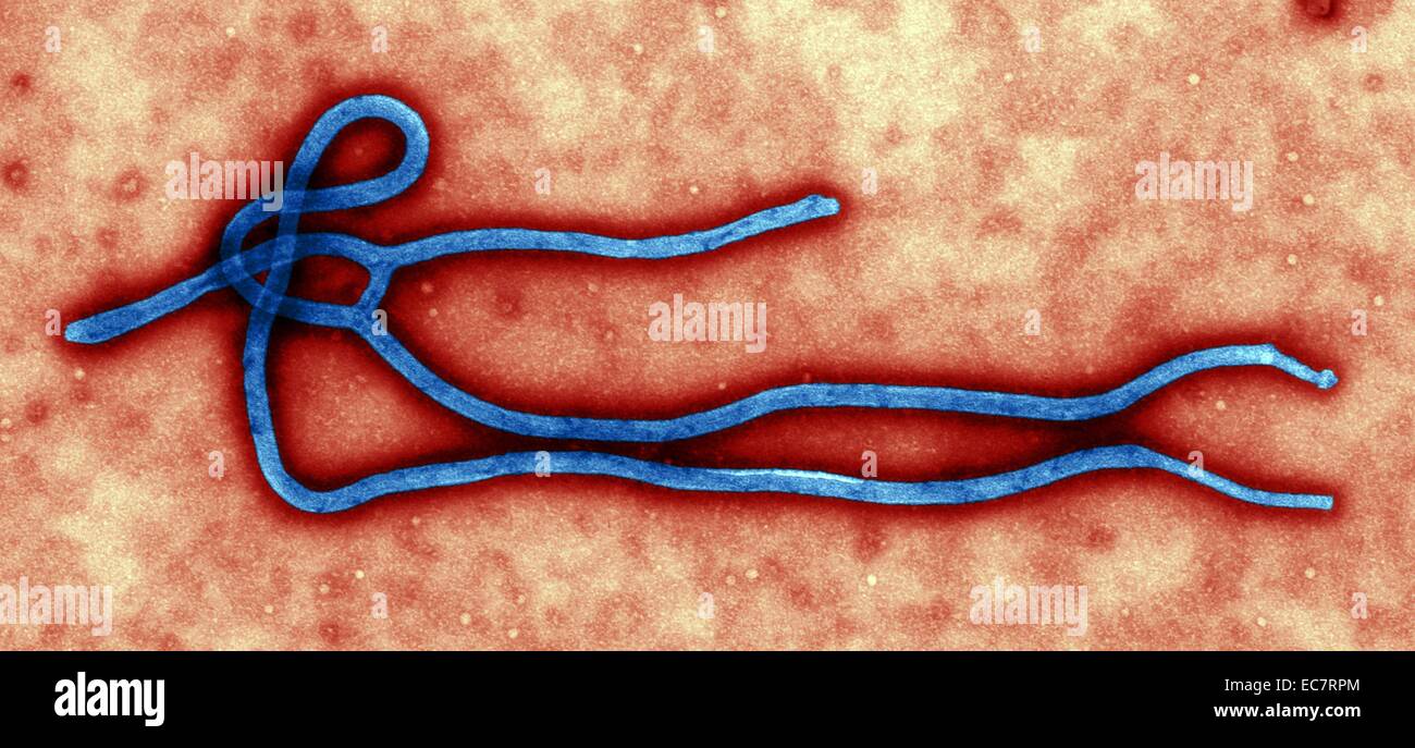 Colorized transmission electron micrograph (TEM), Created by CDC microbiologist Cynthia Goldsmith,  ultra structural morphology displayed by an Ebola virus virion Stock Photo