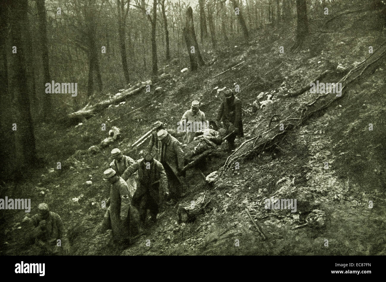 Photograph of the transportation of the wounded from the French front lines. Dated 1915 Stock Photo