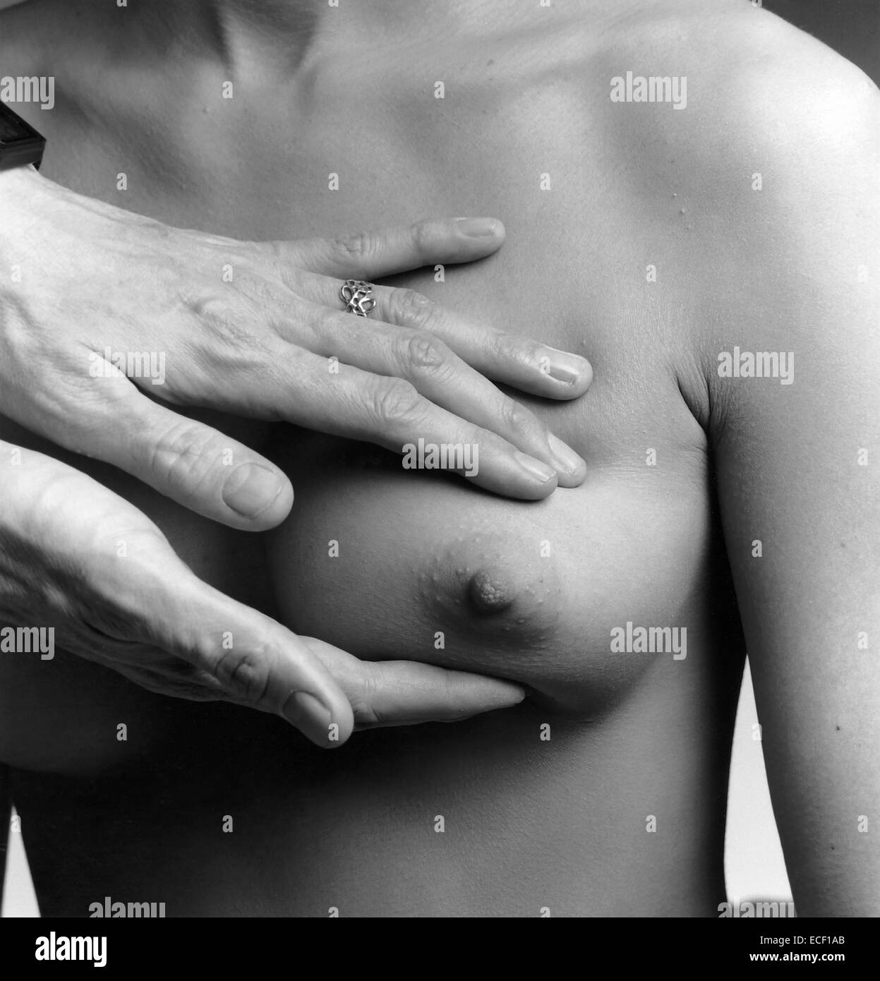 A female nude from the waist up with a doctors hands conducting a clinical breast examination. Stock Photo