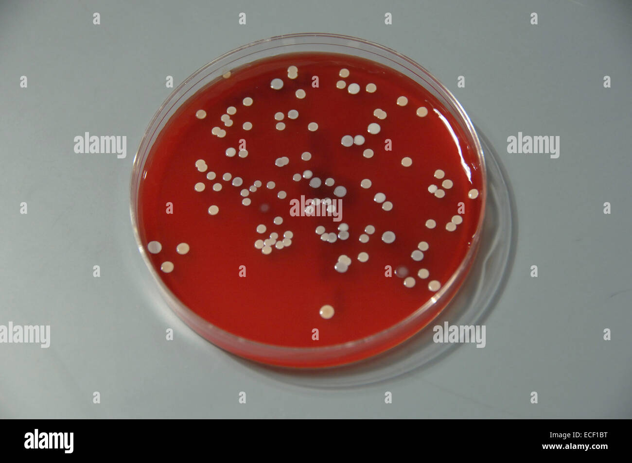 Bacteria from human skin grown on agar in the laboratory. Stock Photo